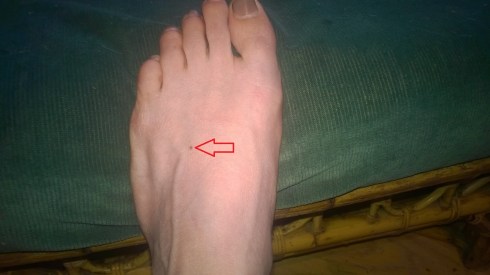 I know. It's hard to believe I can still walk.